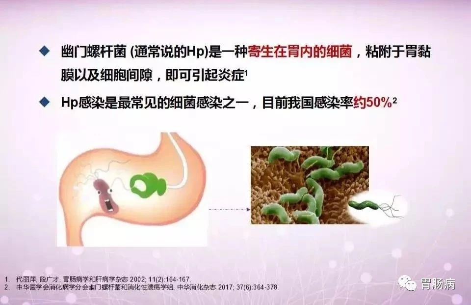 图片 30