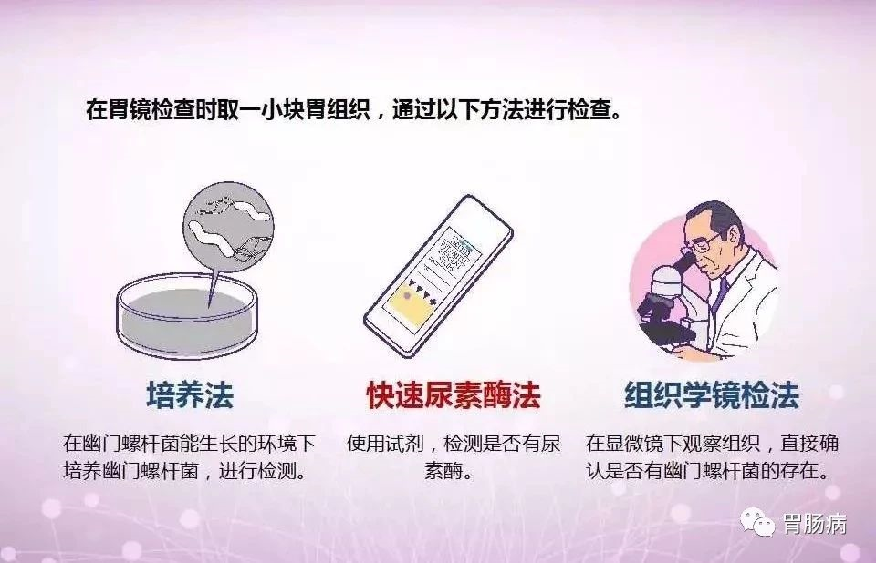 图片 40