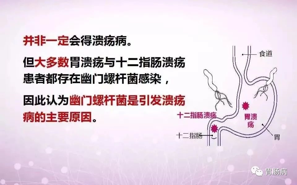 图片 43