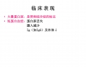 肾病综合征1_6