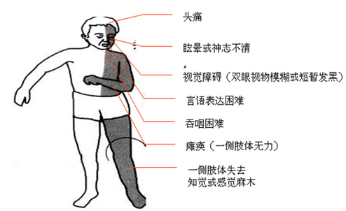 图片 19