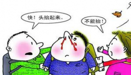 鼻出血相关知识