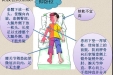 良肢位的摆放