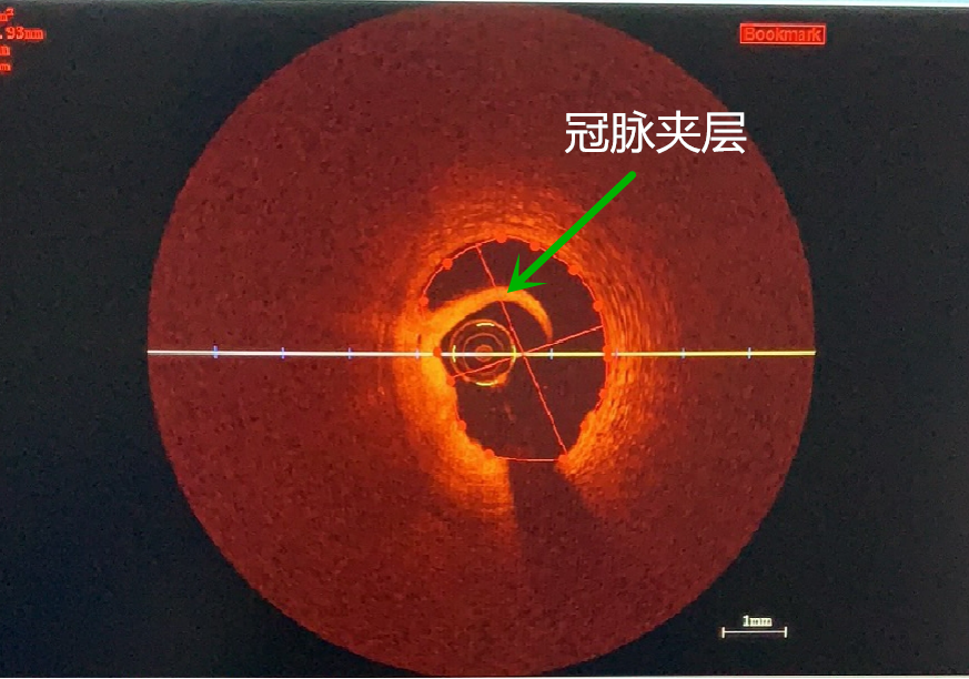 图片 7