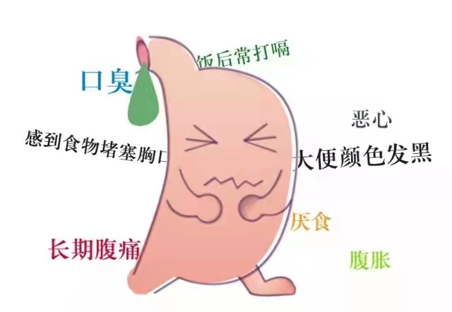 图片 30