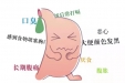 【敬畏生命 关注麻醉】麻醉周系列科普--无痛胃肠镜