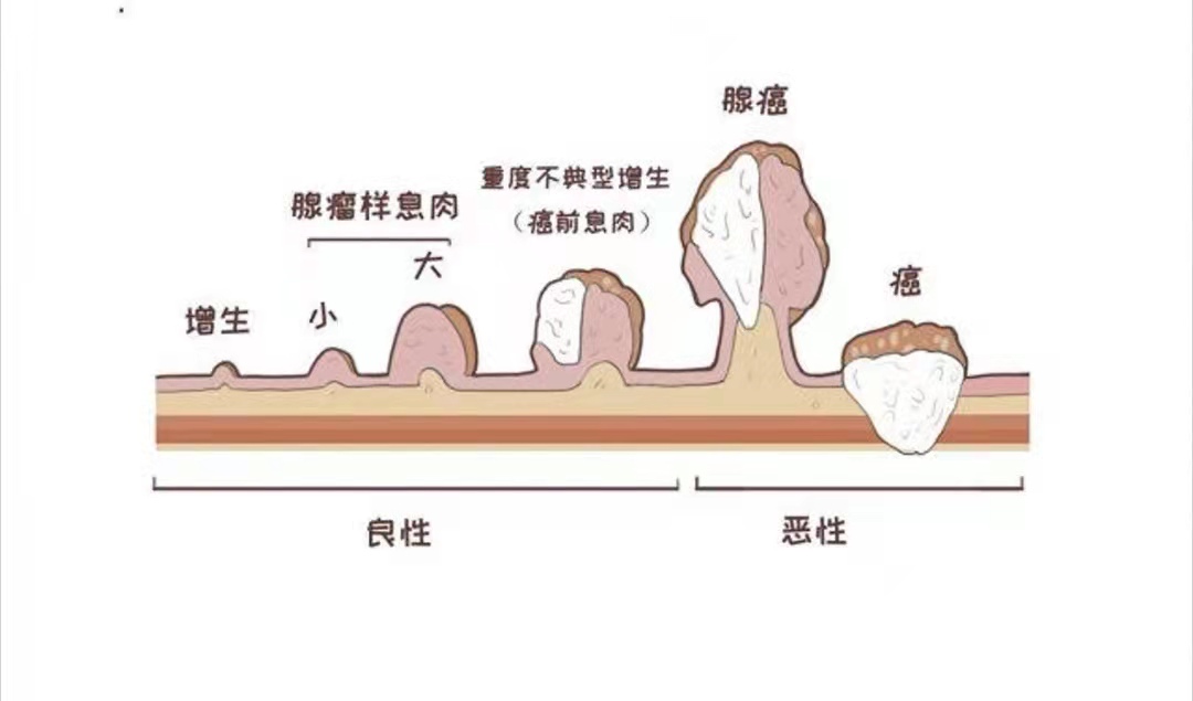 图片 40