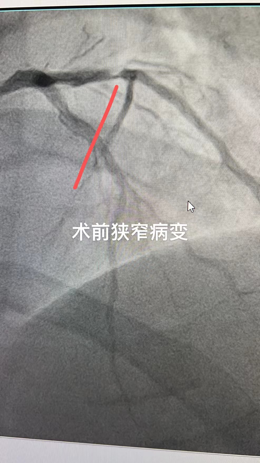 图片 33