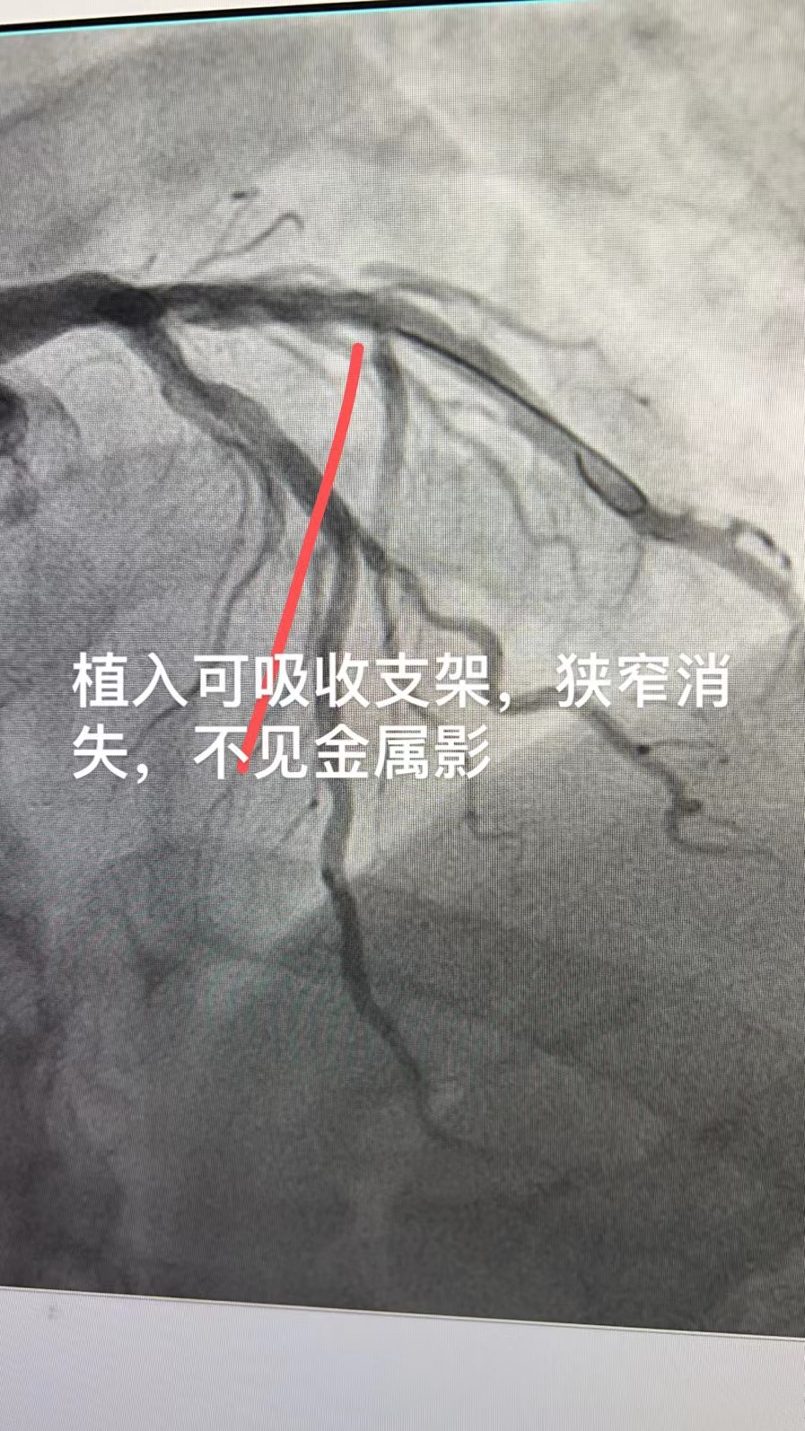 图片 36