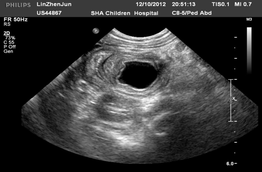 Picture 3