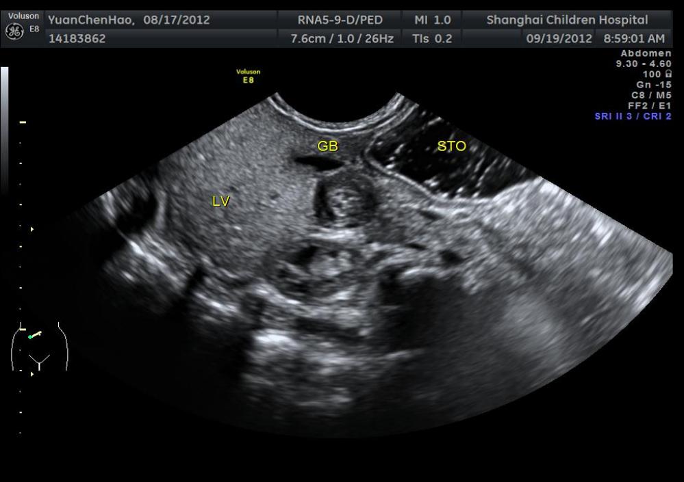 Picture 2