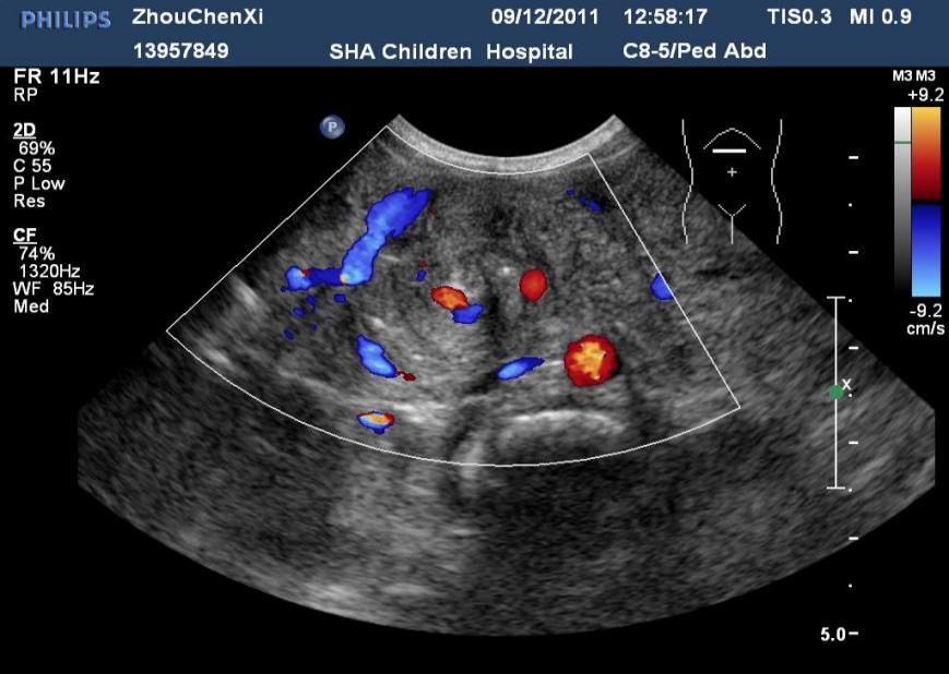 Picture 3